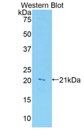 Western Blot; Sample: Recombinant protein.