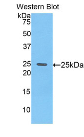 Western Blot; Sample: Recombinant protein.