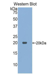 Western Blot; Sample: Recombinant protein.