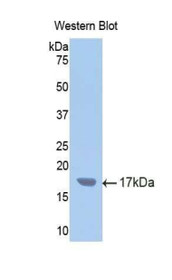 Western Blot; Sample: Recombinant protein.