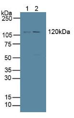 Western Blot; Sample: Lane1: Human Hela Cells; Lane2: Porcine Brain Tissue.