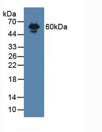 Western Blot; Sample: Mouse Serum.
