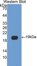 Western Blot; Sample: Recombinant protein.