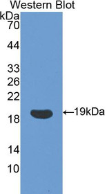 Western Blot; Sample: Recombinant protein.