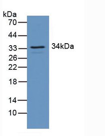Western Blot; Sample: Mouse Brain Tissue.