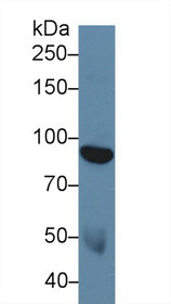 Western Blot; Sample: Human Serum; Primary Ab: 5µg/ml Rabbit Anti-Human DDR1 Antibody Second Ab: 0.2µg/mL HRP-Linked Caprine Anti-Rabbit IgG Polyclonal Antibody