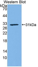 Western Blot; Sample: Recombinant protein.