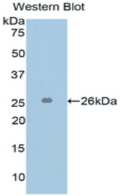 Western Blot; Sample: Recombinant protein.