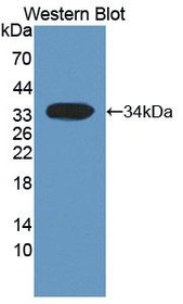 Western Blot; Sample: Recombinant protein.