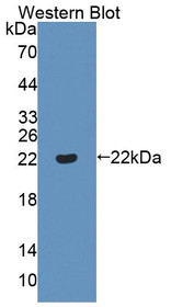 Western Blot; Sample: Recombinant protein.