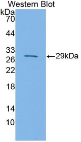 Western Blot; Sample: Recombinant protein.