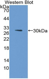 Western Blot; Sample: Recombinant protein.