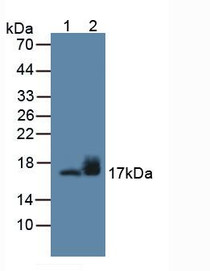 Western Blot; Sample: Lane1: Rat Brain Tissue; Lane2: Mouse Cerebellum Tissue.
