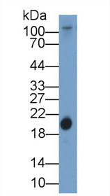 Western Blot; Sample: Gallus Serum; Primary Ab: 1µg/ml Rabbit Anti-Gallus RBP4 Antibody Second Ab: 0.2µg/mL HRP-Linked Caprine Anti-Rabbit IgG Polyclonal Antibody