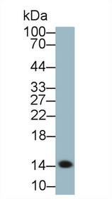 Western Blot; Sample: Human Serum; Primary Ab: 1µg/ml Rabbit Anti-Human SAA Antibody Second Ab: 0.2µg/mL HRP-Linked Caprine Anti-Rabbit IgG Polyclonal Antibody