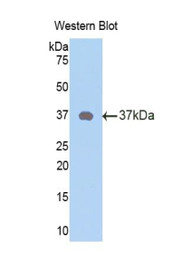 Western Blot; Sample: Recombinant protein.