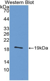 Western Blot; Sample: Recombinant protein.