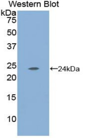 Western Blot; Sample: Recombinant protein.
