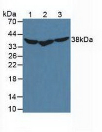 Western Blot; Sample: Lane1: Mouse Liver Tissue; Lane2: Mouse Jurkat Cells; Lane3: Mouse HeLa Cells.