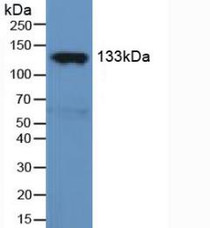 Western Blot; Sample: Rat Serum.