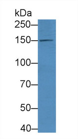 Western Blot; Sample: Mouse Testis lysate; Primary Ab: 2µg/mL Rabbit Anti-Mouse NOS3 Antibody Second Ab: 0.2µg/mL HRP-Linked Caprine Anti-Rabbit IgG Polyclonal Antibody