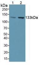 Western Blot; Sample: Lane1: Human Liver Tissue; Lane2: Human Placenta Tissue.