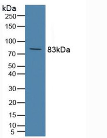 Western Blot; Sample: Rat Serum.
