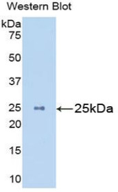 Western Blot; Sample: Recombinant protein.