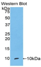 Western Blot; Sample: Recombinant protein.