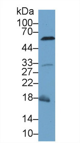 Western Blot; Sample: Mouse Liver lysate; Primary Ab: 1µg/ml Rabbit Anti-Mouse CASP8 Antibody Second Ab: 0.2µg/mL HRP-Linked Caprine Anti-Rabbit IgG Polyclonal Antibody