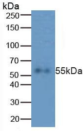 Western Blot; Sample: Human HepG2 Cells.