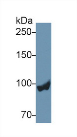 Western Blot; Sample: Rat Liver lysate; Primary Ab: 2µg/ml Rabbit Anti-Rat PYGL Antibody Second Ab: 0.2µg/mL HRP-Linked Caprine Anti-Rabbit IgG Polyclonal Antibody