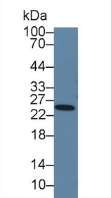 Western Blot; Sample: Rat Serum; Primary Ab: 5µg/ml Rabbit Anti-Rat PRL Antibody Second Ab: 0.2µg/mL HRP-Linked Caprine Anti-Rabbit IgG Polyclonal Antibody