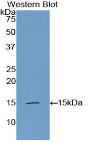 Western Blot; Sample: Recombinant protein.
