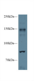Western Blot; Sample: Mouse Cerebrum lysate; Primary Ab: 1µg/ml Rabbit Anti-Mouse NOS2 Antibody Second Ab: 0.2µg/mL HRP-Linked Caprine Anti-Rabbit IgG Polyclonal Antibody
