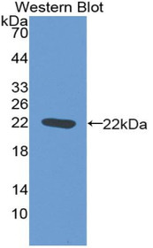 Western Blot; Sample: Recombinant protein.