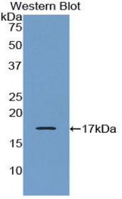 Western Blot; Sample: Recombinant protein.