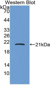 Western Blot; Sample: Recombinant protein.