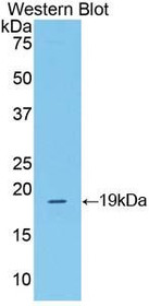 Western Blot; Sample: Recombinant protein.