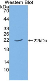 Western Blot; Sample: Recombinant protein.