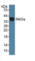 Western Blot; Sample: Rat Serum.