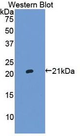 Western Blot; Sample: Recombinant protein.