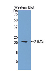 Western Blot; Sample: Recombinant protein.