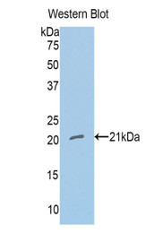 Western Blot; Sample: Recombinant protein.