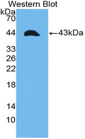 Western Blot; Sample: Recombinant protein.