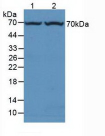 Western Blot; Sample: Lane1: Rat Liver Tissue; Lane2: Mouse Liver Tissue.