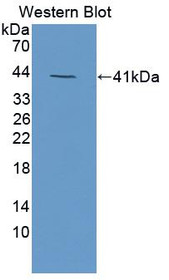 Western Blot; Sample: Recombinant protein.