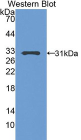 Western Blot; Sample: Recombinant protein.