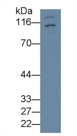 Western Blot; Sample: Recombinant protein.