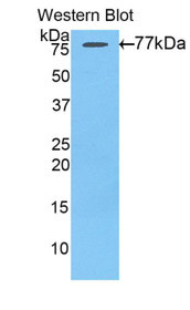 Western Blot; Sample: Recombinant protein.